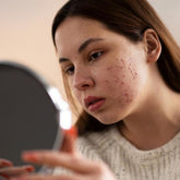 O que você já deixou de fazer por causa da acne