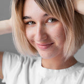 Acne Adulta e Hormonal: Causas e Cuidados