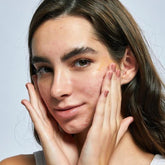 Acne e Autoestima: Como o Maior Órgão do Corpo Reage à Inflamação